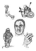 Injuries - Stock Art